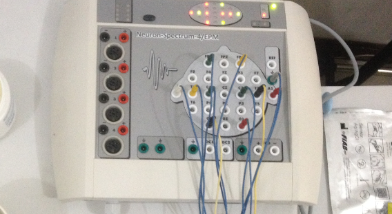 俄罗斯 NEUROSOFT脑电肌电诱发电位一体机
