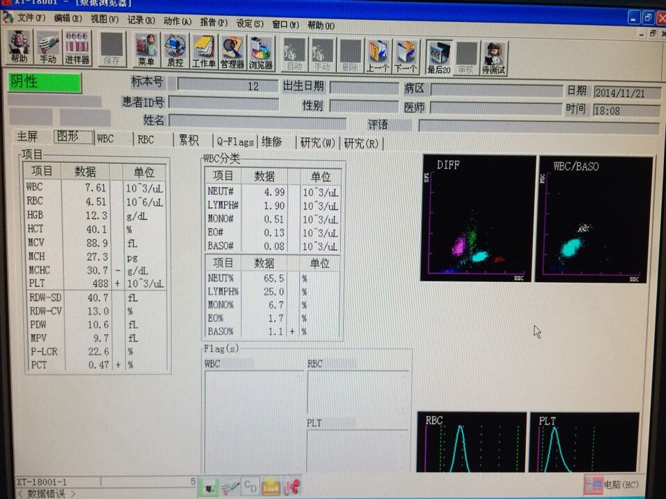 SYSMEX-2000I出售，这是刚做的结果，QQ50552689